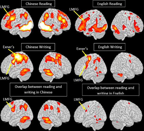 Brain-activation-for-each-task-in-each-language-Chinese-reading-English-reading